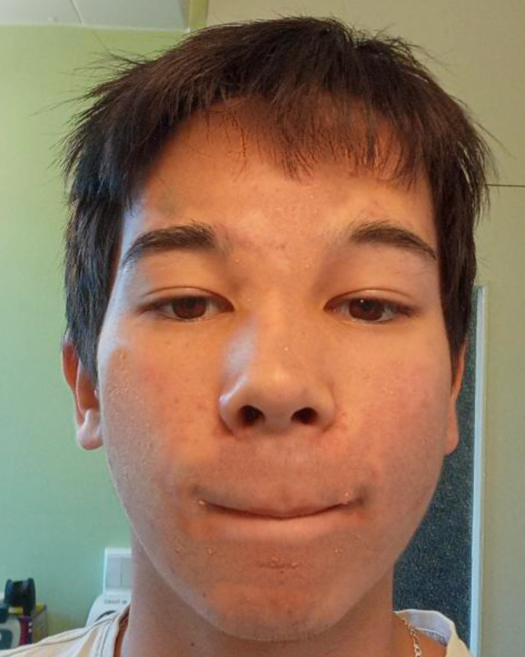 Après transformation