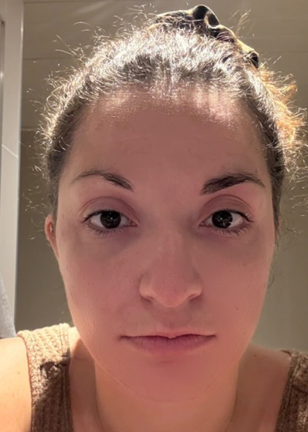 Après transformation