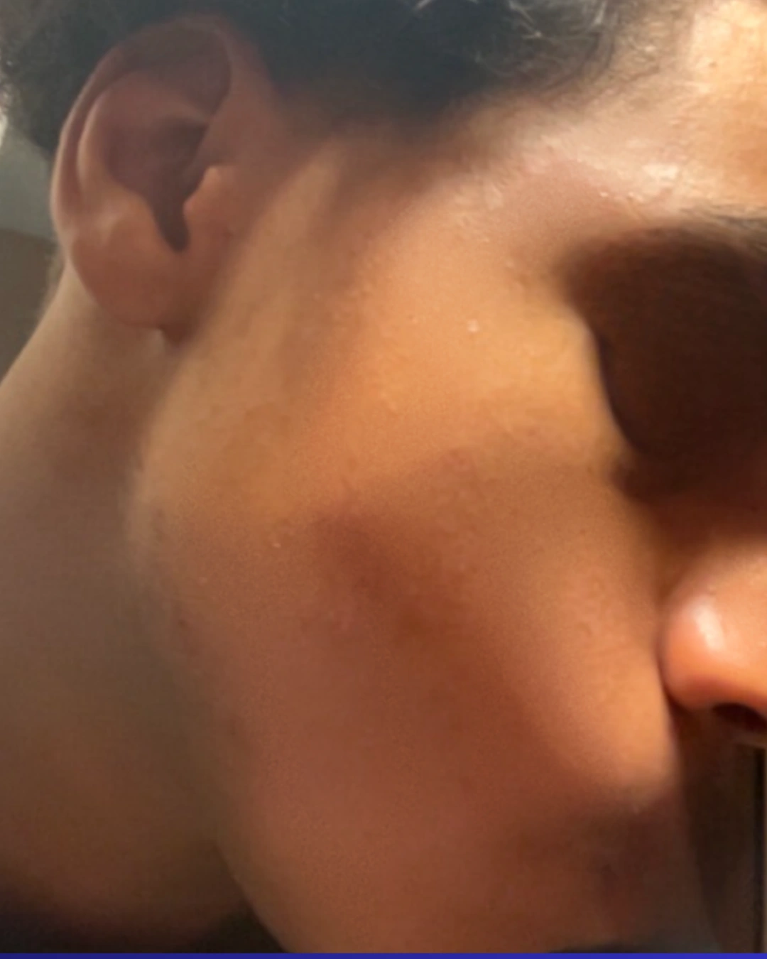 Après transformation