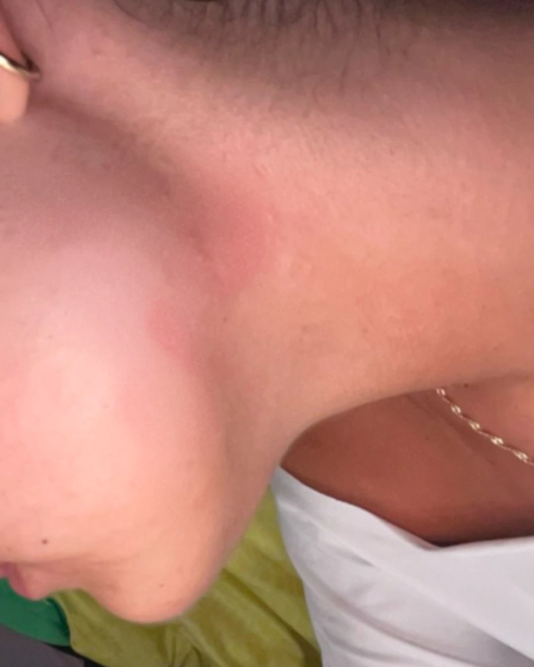 Après transformation