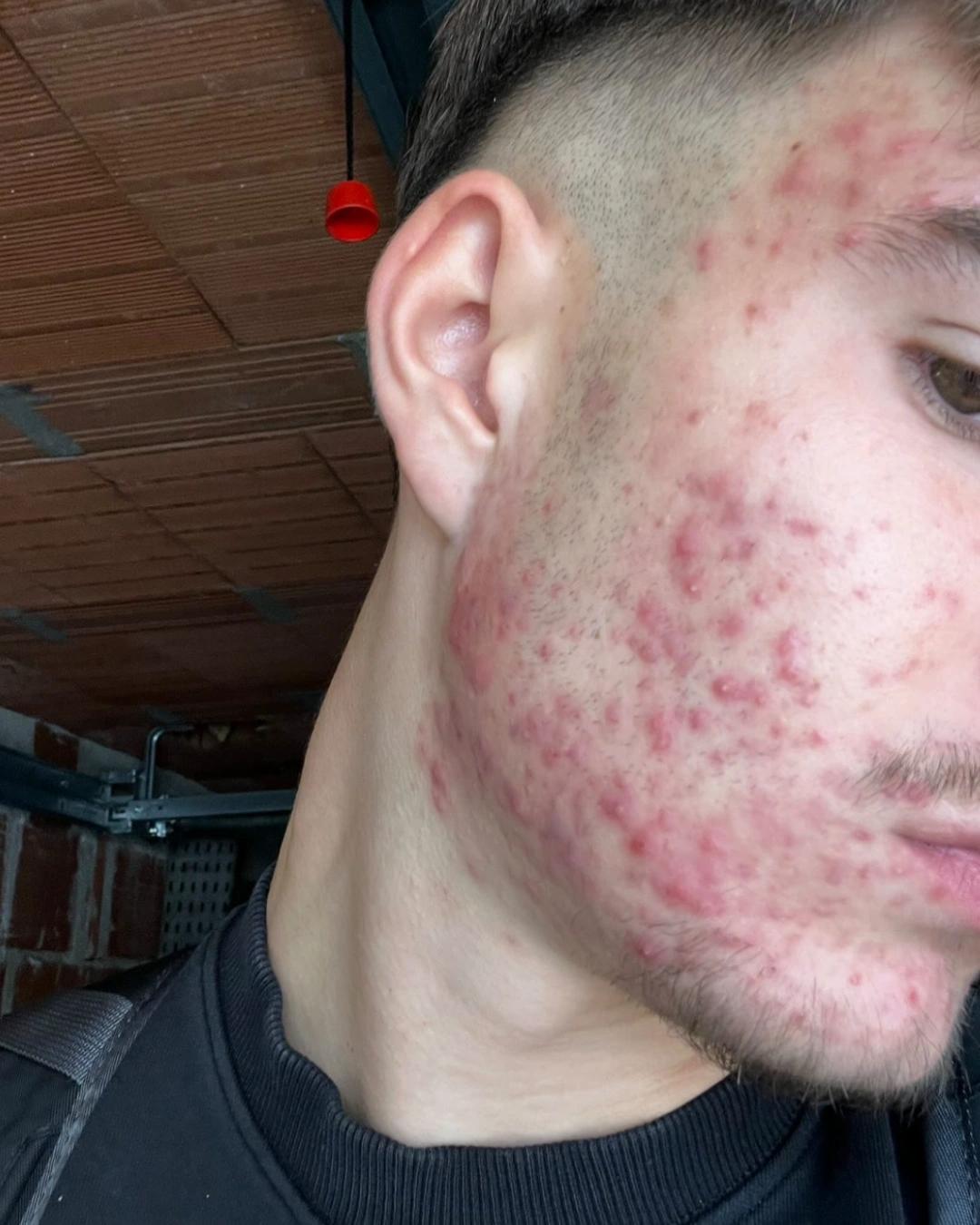 Avant transformation