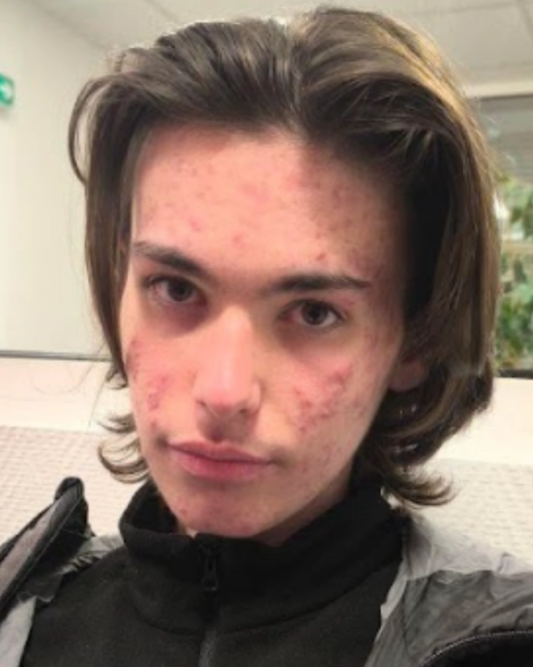 Avant transformation