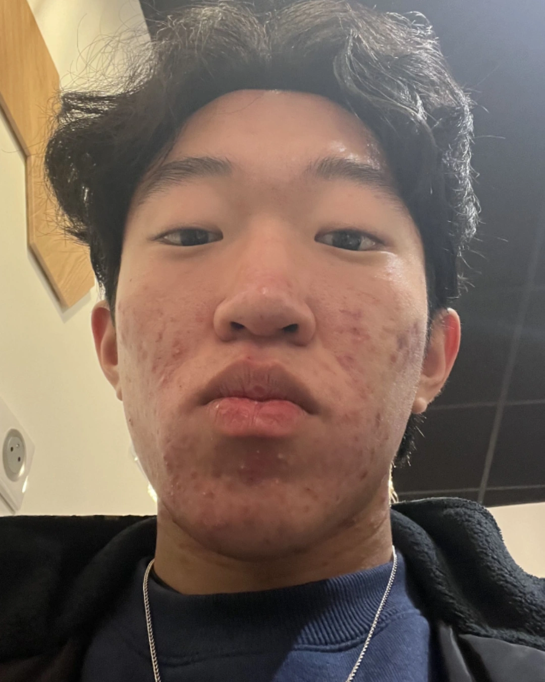 Avant transformation