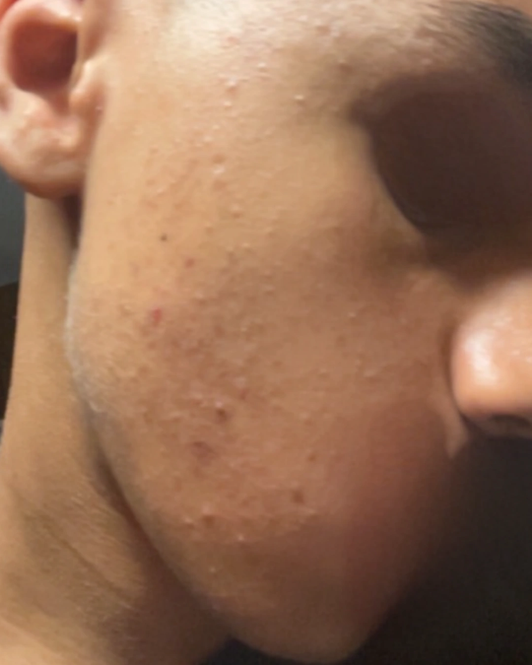 Avant transformation