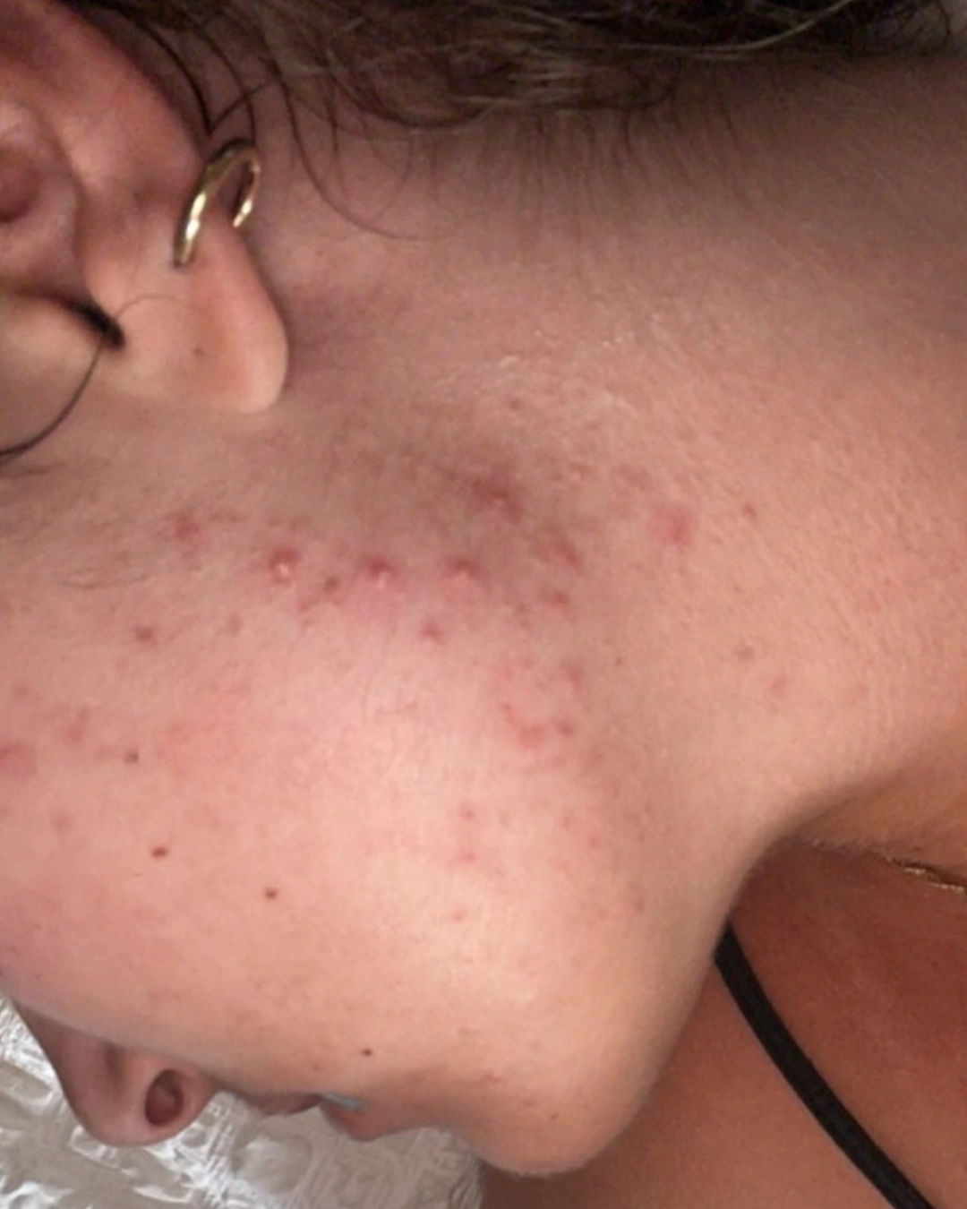 Avant transformation