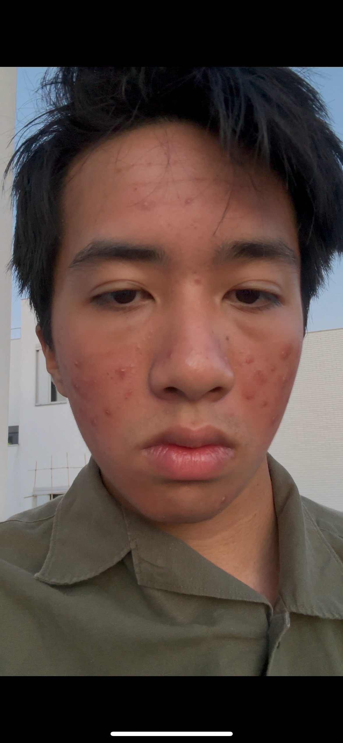 Étape 2 - Les fausses solutions